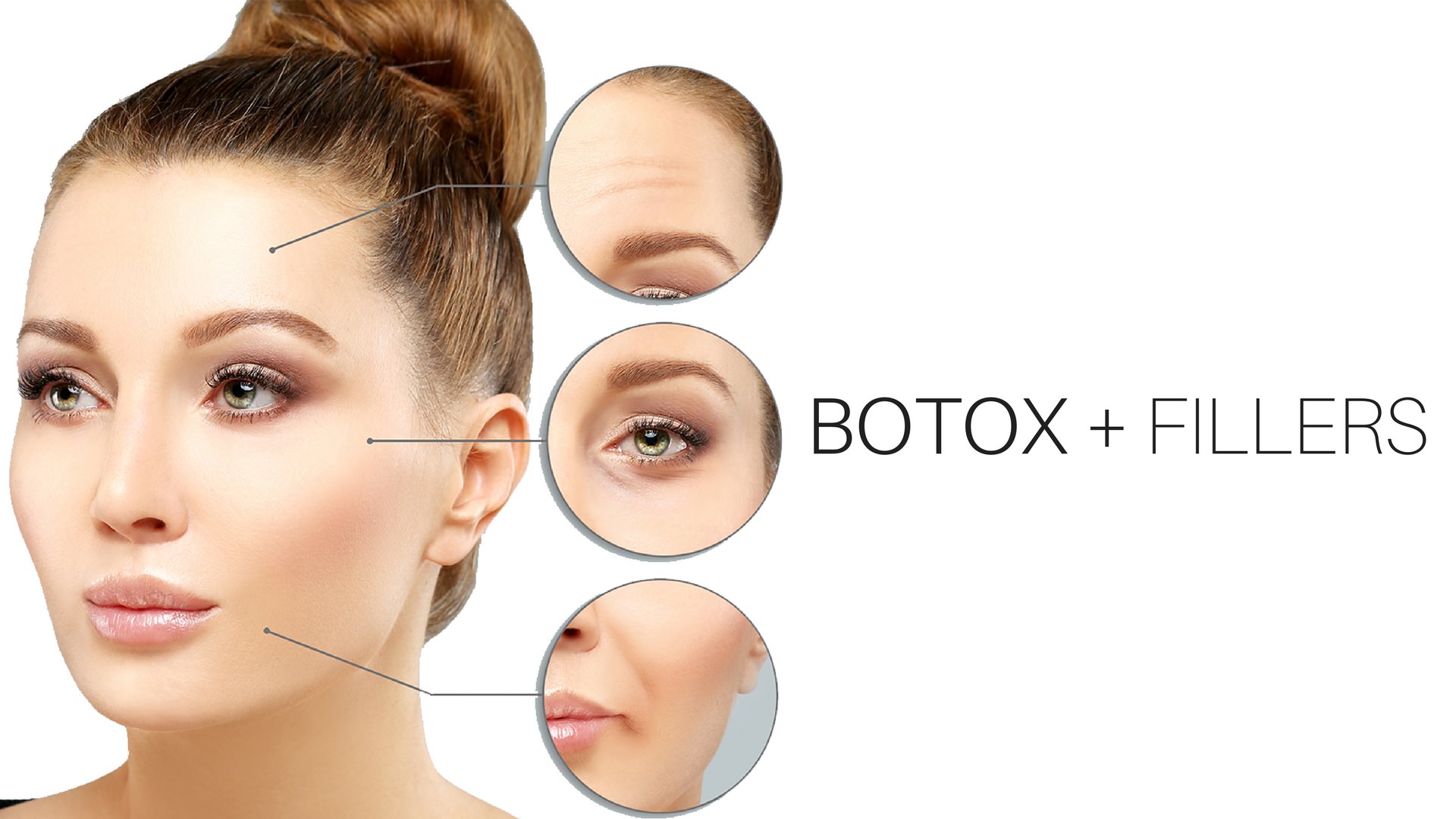 botox and fillers image