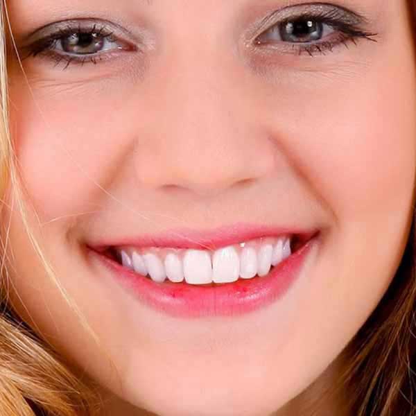 white teeth image