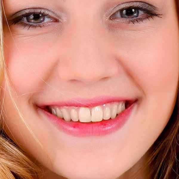 brown teeth image